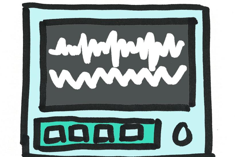 Drawing of a vital signs monitor 