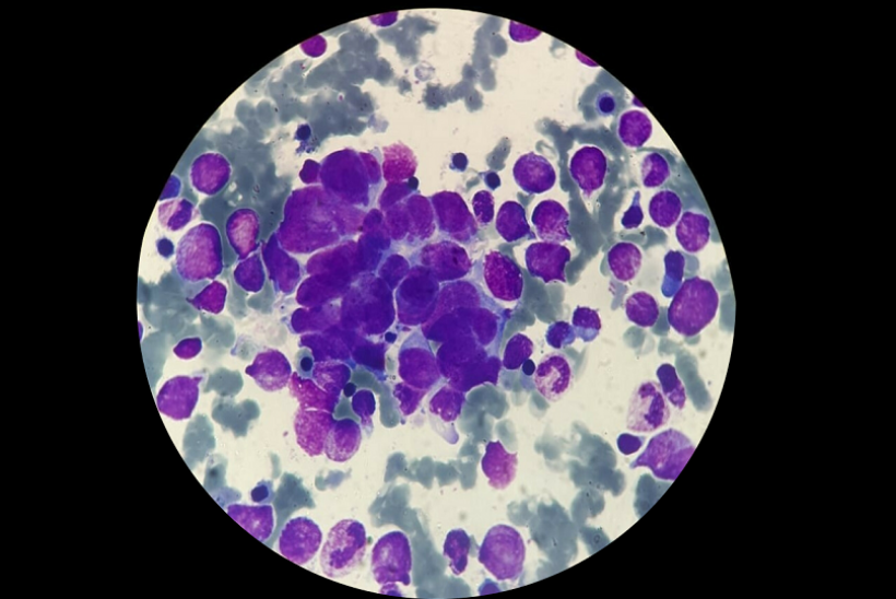 Neuroblastoma cells 
