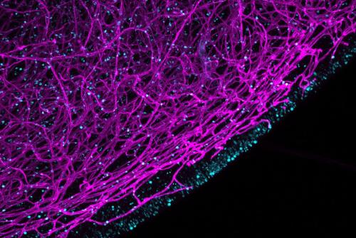 ‘Insights into Down’s syndrome brainstem’ was entered by Post-Doctoral Researcher Ekin Ucunco. This image shows blood vessels (pink) and proliferative cells (blue/green) in the hindbrain of a foetus with Down’s syndrome. 
