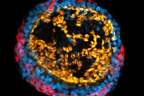 ‘My lung is on fire’ was entered by PhD student Giuseppe Cala. This image shows a lung ‘mini-organ’, known as an organoid, grown from stem cells.